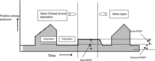 Figure 4 Expiratory hold maneuver to estimate auto-PEEP. The valves are shut off at the end of expiration. When the flow equals zero the pressure rises to the total PEEP level. Subtracting any external PEEP, if applied, from the total PEEP gives the value of auto-PEEP.