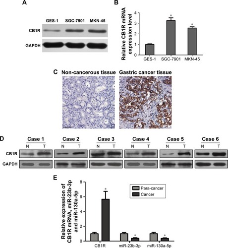 Figure 1 CB1R is highly expressed in GC.