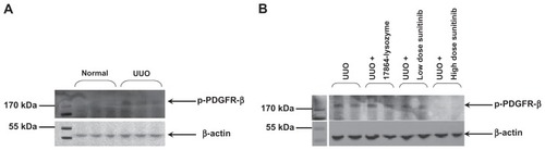 Figure 7 Western blot analysis of activated PDGFR-β (p-PDGFR-β) levels in the renal cortex. (A) Three days ureteral obstruction resulted in an increased activation of PDGFR-β tyrosine kinase. (B) Inhibitory effects were only obtained with daily intraperitoneal injections of 50 mg/kg sunitinib malate.Abbreviations: PDGFR, platelet-derived growth factor receptors; UUO, unilateral ureteral obstruction.