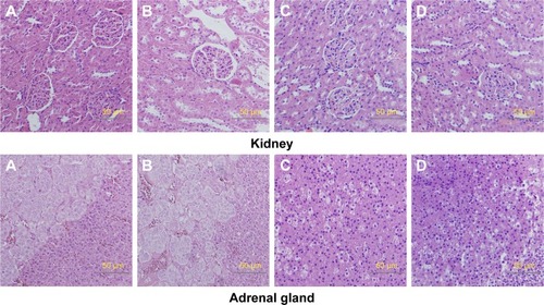Figure 9 Histologic sections of kidney and adrenal gland.Notes: (A) Male rats of nano-Cu/LDPE group. (B) Male rats of control group. (C) Female rats of nano-Cu/LDPE group. (D) Female rats of control group. No abnormalities were detected in any groups.Abbreviation: Cu/LDPE, copper/low-density polyethylene nanocomposite.