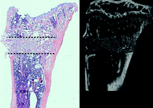 Figure 3. Inter-trabecular bone formation 7 days after a drill hole (dotted line) in the proximal tibia of a mouse. A. Histology. B. MicroCT (not the the same sample).