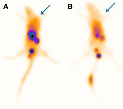 Figure 12 Tumor imaging of nude mice bearing A549 tumor 1 hour after injection of 3.7 MBq of 99mTc nanoconjugate (A) without and (B) with coadministration of 10 mg/mL of glutamine (glutamine blocking). The arrows indicate the tumor site.