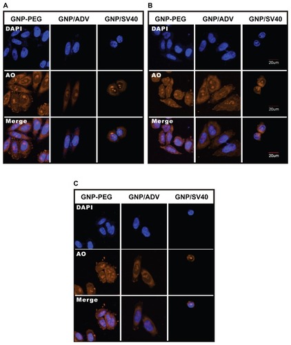 Figure 3 Subcellular distribution of total RNA in cells treated with GNP-PEG, GNP-PEG/ADV, and GNP-PEG/SV40 for (A) 3, (B) 6, and (C) 9 hours. RNA was stained with acridine orange (yellow color) and observed by confocal microscopy. Total RNA was gradually restricted inside the nucleus (DAPI, blue color) with GNP-PEG/SV40 treatment, but not with GNP-PEG or GNP-PEG/ADV (throughout the cytoplasm and nucleus).Abbreviations: ADV, adenovirus; DAPI, 4′,6-diamidino-2-phenylindole; GNP, gold nanoparticle; PEG, poly(ethylene glycol); SV40, simian virus 40 large T antigen.