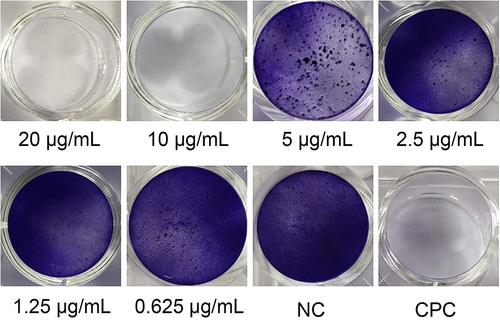 Figure 6 Results of crystalline violet staining for the effect of different solutions on biofilm formation of S. mutans.