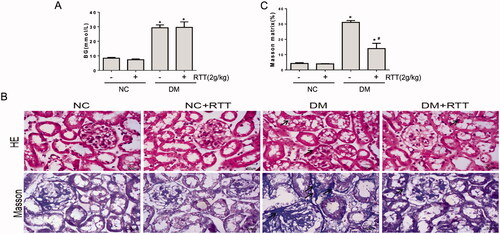 Figure 3. RTT extract treatment improved renal injury in STZ-induced diabetic mice. (A) Blood glucose (BG) from STZ-induced diabetic mice after 28 weeks of RTT extract (2 g/kg) treatment (n = 12, means ± SD, *p < 0.05 vs. NC group); (B) Representative photomicrographs (original magnification, 400×) of HE and Masson staining (blue) of kidney sections in STZ-induced diabetic mice after 28 weeks of RTT extract (2 g/kg) treatment (n = 12). (C) Quantification of Masson staining (n = 12, *p < 0.05 vs. NC group; #p < 0.05 vs. DM group).