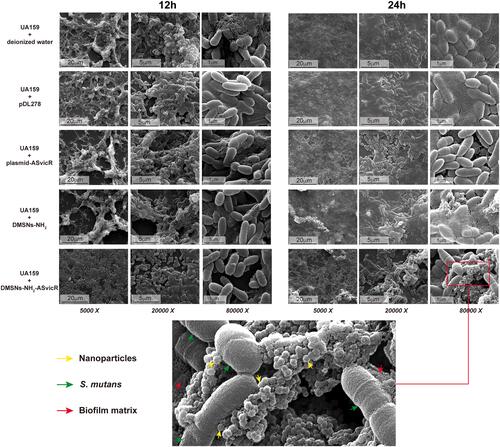 Figure 4 Scanning electron micrograph of biofilms in which S. mutans UA159 were treated with deionized water, pDL278, plasmid-ASvicR, DMSNs-NH2, and DMSNs-NH2-ASvicR thrice and developed in brain heart infusion (BHI) supplemented with 1% sucrose for 12 hours and 24 hours. The partial enlarged view of the 24-hour biofilm in the DMSNs-NH2-ASvicR group shows that nanoparticles clustered around S. mutans, and some nanoparticles even directly contacted the surface of Streptococcus mutans.