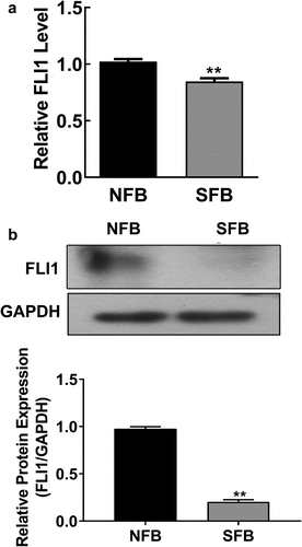 Figure 2. Downregulation of FLI1 expression in primary human skin fibroblast