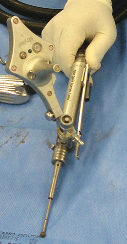 Figure 1. The specially developed burr attached to the navigation probe in order to monitor its location within the tumor cavity.