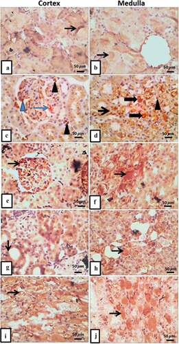 Figure 5. (a-j) Micrographs represent IHC expression of ET-1 in renal cortical and medullary areas in different treated groups. a) control group demonstrates few expressions in cortical tubular epithelium, and b) it reveals faint expression in tubulo-interstitium. c) T2DM shows intense expression of ET-1 in glomerular capillary (thin blue arrow), increased expression in mesangial cells (blue arrowhead), interstitial macrophages and lymphocytes (arrow heads), and in d) it shows intense expression of ET-1 in cytoplasm and lumen of medullary tubules with mild expression in interstitial cells and capillaries. e) T2DM + thyroidectomy demonstrates strong glomerular mesangial and epithelial cells expression of ET-1 (thin arrow), and in f) it shows overexpression of medullary tubulo-interstitium. g) operative sham group shows moderate expression in tubular epithelial cells, and H) shows moderate expression in medullary tubulointerstitium. i) T2DM + thyroidectomy + L-thyroxine shows moderate intraluminal expression of ET-1., and J) shows moderate expression in medullary interstitium. Image magnification = 400×, scale bar = 50 µm.
