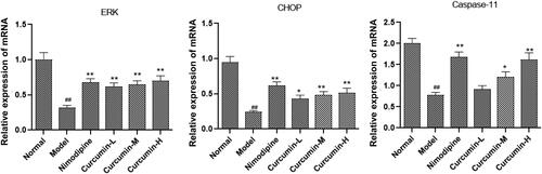 Figure 6. Effect of curcumin on the expression of ERK, CHOP and caspase-11 mRNA in rat brain tissue. Real-time PCR was performed to detect ERK, CHOP and caspase-11 mRNA levels. Compared with the normal, ##p < 0.01; compared with the model, *p < 0.05, **p < 0.01.