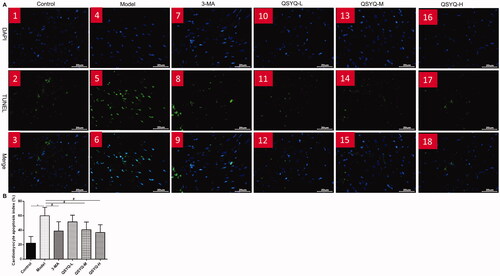 Figure 3. Effect of QSYQ on myocardial apoptosis in rats. (A) Typical pictures of myocardial TUNEL fluorescence staining (×400). (B) Apoptosis index of rat cardiomyocytes. *p < 0.01, #p < 0.05.