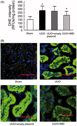 Figure 2. IMD inhibits ROS production in the kidney after UUO. (A) The level of tubulointerstitial superoxides measured by DHE staining. Data in bar graphs are means ± SD, n = 6. *p < .05 versus the sham control group; #p < .05 versus the UUO group. (B) Respective immunofluorescence staining of 4-hydroxynonenal (4-HNE). Original magnification, ×400. Scale bars: 50 μm.