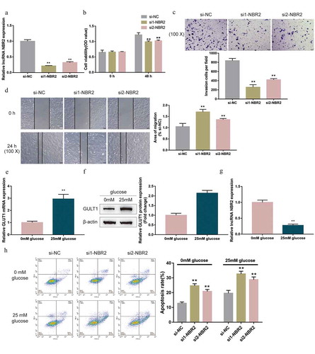 Figure 2. Effects of lncRNA NBR2 on hepatoblastoma cell phenotype (a) LncRNA NBR2 silencing was achieved in HepG2 cells by transfecting small interfering RNA targeting lncRNA NBR2 (si1-NBR2 and si2-NBR2). Si-NC was transfected as a negative control. The transfection efficiency was verified using real-time qPCR. Next, HepG2 cells were transfected with si1-NBR2 or si2-NBR2 and examined for (b) cell viability by MTT assay; (c) cell invasion by Transwell assay; (d) cell migration by wound healing assay. (e-g) HepG2 cells were cultured in a medium containing 0 mM or 25 mM glucose, and examined for the expression of GLUT1 mRNA, protein and lncRNA NBR2 by real-time qPCR and Immunobloting. (h) HepG2 cells were transfected with si1-NBR2 or si2-NBR2, cultured in a medium containing 0 mM glucose, and examined for cell apoptosis by Flow cytometry assay. **P < 0.01