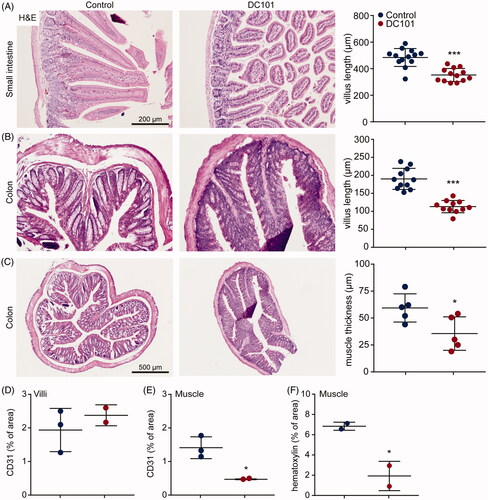 Figure 6. Nab-paclitaxel elimination is associated with altered intestinal mucosa. (A) Nude mice were treated with 40 mg/kg DC101 or PBS control therapy twice a week for four weeks and intestine were collected for histological analysis. Small intestine was stained for H&E and villus length was measured using ImageJ software, 4–5 villi were measured per section. (B) Colon was stained for H&E and villus length was measured using ImageJ software, 2–3 villi were measured per section. (C) Thickness of the muscle layer lining the colon was measured using ImageJ software, 1–2 areas per section were measured for muscle thickness. (D) Villi of the intestine were immunohistochemically stained for CD31 and quantified using ImageJ as percentage of area. (E) The muscle layer lining the colon was immunohistochemically stained for CD31 and quantified using ImageJ as percentage of area. (F) The amount of nuclei (hematoxylin) in the muscle layer lining the colon was quantified using ImageJ and depicted as percentage of area. Scatter dot plots show the mean ± SD, n = 3 per group. *p < .05, ***p < .001 was determined by two-sided unpaired t-tests and analyzed against untreated control.