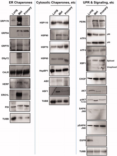 Figure 2. Chaperone and UPR and related signaling molecule expression in canine lung and tumors. Western blots of normal canine lung lysate (“Lung”) STAR metastatic/recurrent (“Met”) and original primary (“Primary”) tumor lysates were probed for the ER chaperones (left panel) listed, for the (typically) cytosolic chaperones (middle panel) listed, and for proteins involved in the UPR and downstream signaling (right panel). Anti-TUBB (beta tubulin) staining is used as an internal loading control.
