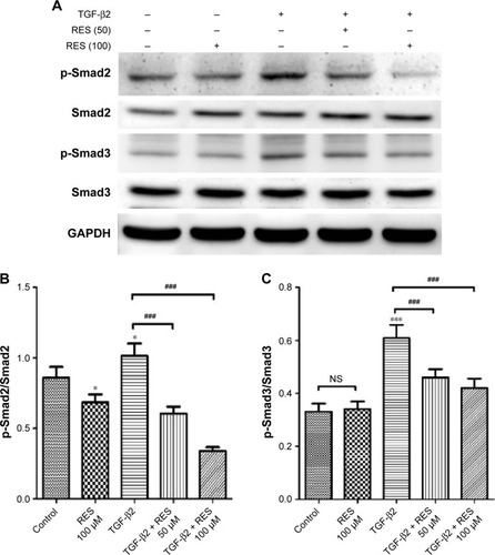 Figure 6 Effects of resveratrol on phosphorylation of Smad2 and Smad3 in TGF-β2-treated ARPE-19 cells.