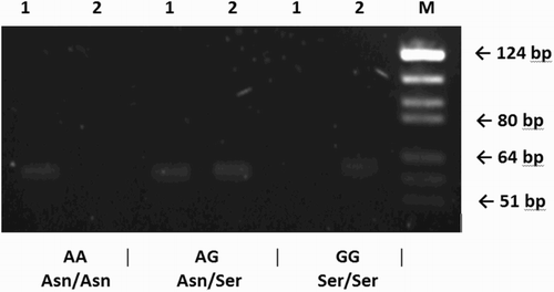 Figure 2. Allele-specific PCR of FSHR gene in three different samples visualized on agarose gel. Genotypes of each individual are shown beneath the figure: band of 61 bp present or absent. Number one and two above each line stand for A and G allele, respectively. FSHR: follicle stimulating hormone receptor; M: molecular size marker (pBR322 DNA/BsuRI Digest, Fermentas)