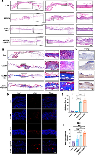 Figure 7 ApoSEV promotes wound healing and angiogenesis. (A) H&E staining of regenerated skin tissue in Control, GelMA, GelMA+EV and GelMA+apoSEV groups at day 14. Scale bar = 100 μm. (B) Masson staining of regenerated skin wounds in different groups at day 14. Scale bar = 100 μm. (C) Immunohistochemical staining of VEGF in regenerated skin tissue in different groups at day 14. (D) immunofluorescence staining of CD31 in regenerated skin tissue in different groups at day 14. Scale bar = 100 μm. (E) Quantitative analysis of collagen ratios of Masson staining of regenerated skin wounds in different groups at day 14. (F) The quantitative analysis of the relative mean density of immunohistochemical staining for CD31 in regenerated skin tissue among various experimental groups on day 14. The data represent the mean ±SD in the figures. Significant differences between groups are indicated as * P< 0.05; ** P < 0.01; *** P < 0.001.