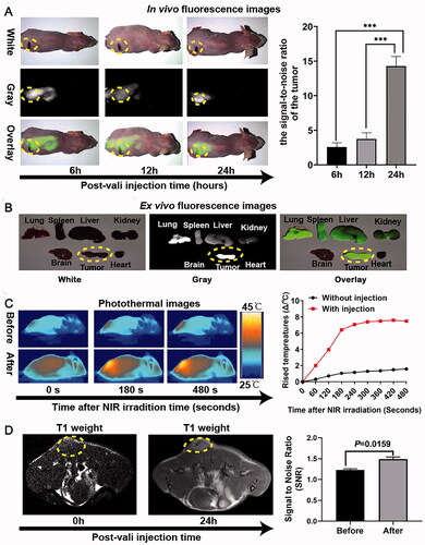Figure 6. In vivo multimode imaging behaviors of HMON@CuS/Gd2O3 NPs in SKOV-3 cells. (A&B) In vivo and ex vivo fluorescence images of tumor-bearing mice 6, 12, and 24 h after treatment with HMON@CuS/Gd2O3 NPs, *** p < .001. (C) IRT images (left) and statistical temperature changes (right) of tumor-bearing mice at the indicated time points. (D) MRI images (left) and statistical signal-to-noise ratio (right) of tumor-bearing mice.