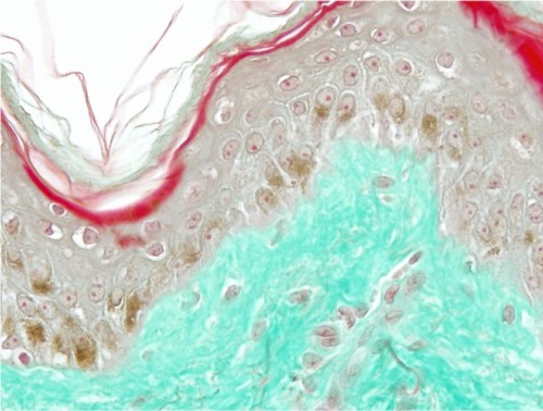 Figure 11 Skin section of one sample explant on day 8 (Centella asiatica-treated batch).