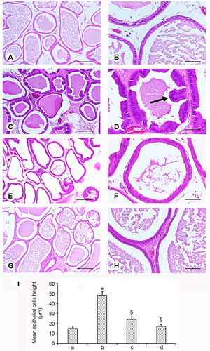 Figure 3 Histological observations of the effects of β-sitosterol and Kigelia extract on testosterone induced hyperplasia in the rat prostate. Sections of prostate in control group (A and B) show acini of variable size lined by a low columnar epithelium; acini are filled with pale eosinophilic material. In testosterone-treated group (C and D), the epithelial cells show increased number and height, with proliferation of the fibromuscular stroma. The walls of acini are thicker with many infoldings projecting into the lumen (arrow). In β-sitost+Testost (E and F) and extract+Testost groups (G and H), a reduction of epithelial cell height and of stromal proliferation is evident. Statistical evaluation of the mean epithelial height in the different groups (a = control; b = testosterone treated; c = β-sitosterol + testosterone treated; d = extract + testosterone treated). *p < 0.05 versus vehicle control; §p < 0.05 versus testosterone treated) (I) (Scale bar: A, C, E, G = 250 μm; B, D, F, H = 50 μm).