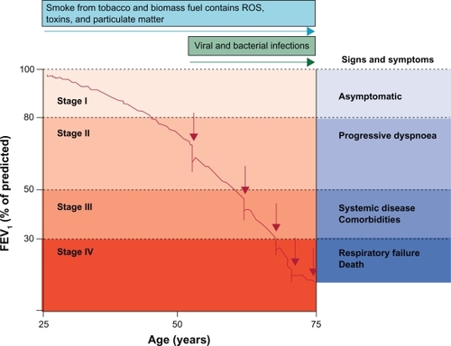 Figure 3 The role of exacerbations in accelerating lung function decline. Exacerbations (indicated by red arrows) punctuate and hasten lung function decline. Hansel TT, Barnes PJ. New drugs for exacerbations of chronic obstructive pulmonary disease. Lancet. 2009;374(9691):744–755.83 Copyright © 2009 Elsevier.