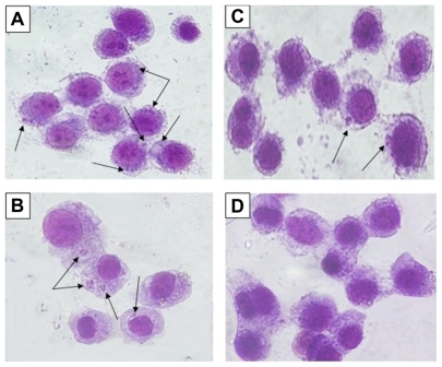 Figure 7 Microscopic views of macrophages infected or not infected by parasites after being stained with Giemsa. Leishmania tropica promastigotes (A) in the control group held in the dark and (B) in the control group exposed to ultraviolet (UV) light infected the macrophages. (C) L. tropica promastigotes exposed to silver nanoparticles (Ag-NPs) in the dark also infected macrophages, but their infectivity was very low compared with the control groups. (D) L. tropica promastigotes exposed to Ag-NPs under UV light did no infect the macrophages. (Arrows indicate macrophage-infected parasites.)