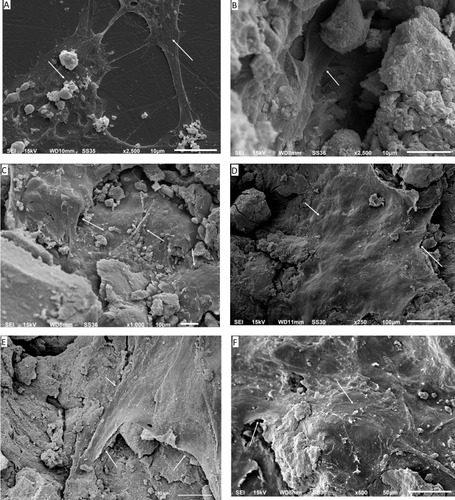 Figure 4 Scanning electron microscopy images of the osteoblasts in various magnifications. (A) Control cells grown on the plastic plate; (B) cells grown on pure HA as a control. It can be seen that the cells have infiltrated into the pores; (C) shows cells grown on p-MWCNTs-PVA; (D) shows cells on f-MWCNTs-PVA, note that the cells are flat and extending to cover large surfaces of the substratum; (E) shows cells on p-MWCNTs-HTAB; (F) shows cells on f-MWCNTs-HTAB. The arrows show the presence of the cells on the composites.