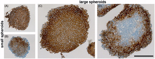 Figure 6. Immunohistochemical analysis of CA IX expression in either small (A and B) or large (C and D) spheroids from SiHa cells. A and C: Staining pattern of CA IX in spheroids cultivated without encapsulated antibody (positive control). Standard immunohistochemical staining of CA IX was performed with both primary (hybridoma medium diluted 1:100) as well as secondary antibody. CA IX-specific staining (brown color) is localized across the spheroid. B and D: Uptake of the encapsulated M75 antibody into SiHa spheroids that was determined by incubation of paraffin sections only in secondary anti-mouse antibody. All sections were counterstained with Mayer’s hematoxylin (blue nuclei). The scale bar is equal to 200 μm.