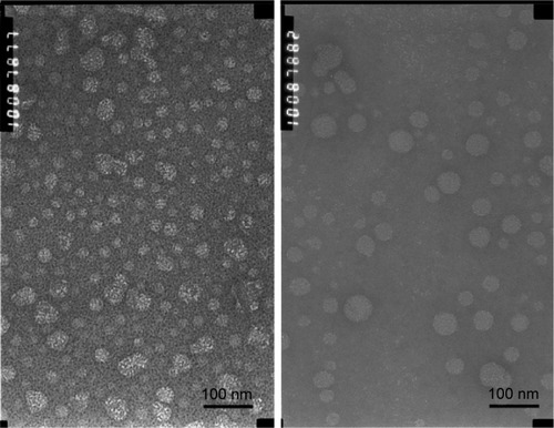 Figure 2 TEM images of DOX-loaded PLSs (left) and Lf-PLSs (right).Abbreviations: DOX, doxorubicin; Lf-PLS, lactoferrin-modified PEGylated liposome; PEG, polyethylene glycol; PLS, PEGylated liposome; TEM, transmission electron microscope.