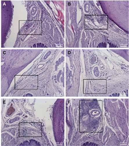 Figure 4 Histological analysis of the upper right first molar oral mucosa in rats 24 hours after local anesthetic administration: (B) BVC; (D) BVCALG; (F) NPALG. The left side was respectively used as control: (A) control BVC; (C) control BVCALG; (E) control NPALG.