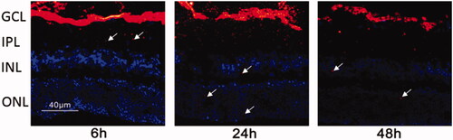 Figure 4. Fluorescent tracing image of the miRNA/NP-BRZ injected into the vitreous body at different time intervals. After 6 h of vitreous injection, the miRNA/NP-BRZ could pass through the vitreous body and reach the fundus of the eye and the GCL layer in the retina. After 24 h, some of the miRNA/NP-BRZ entered the INL layer and the ONL layer. After 48 h, nanoparticles could still be found in all layers of the retina. Scale bar: 40 μm.