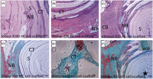 Figure 3. Representative photomicrographs of the scaffold-stem cell groups demonstrating the defect area surrounded by compact bone. Left column (A, D), middle column (B, E) and right column (C, F) show 30, 90 and 180 days, respectively. F inset shows the bone spicule (indicated by a star) at the center of the cavity. CB: Compact bone; NB: New bone; BD: Connective tissue; S: Scaffold; Bv: Blood vessel; HE: Haematoxylin & Eosin; MT: Masson’s Trichrome.