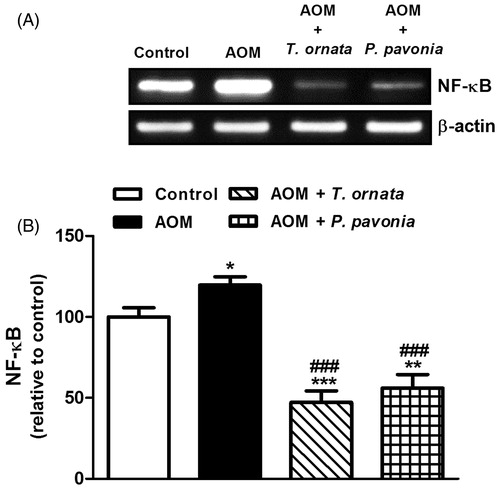 Figure 4. PCR analysis of liver NF-κB in control, AOM and AOM mice treated with T. ornata and P. pavonia. (A) Gel photograph depicting representative NF-κB and β-actin PCR products. (B) Corresponding densitometric analysis of the PCR products. Data are expressed as mean ± SEM. *p < 0.05, **p < 0.01 and ***p < 0.001 versus control and ###p < 0.001 versus AOM. NF-κB, nuclear factor-kappa B; AOM, azoxymethane; T. ornata, Turbinaria ornata; P. pavonia, Padina pavonia; SEM, standard error of the mean.