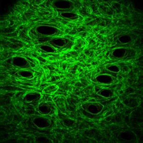 Figure 1. Collagen fibers network image, obtain by SHG imaging of a mice skin under traction (λ = 1.1). The typical size of the image is 400x400µm. Collagen fibers appear in green. Black holes are the hair shafts.