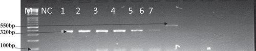 Figure 7. A gel electrophoresis showing the resistance determinants of ermB and ampC gene