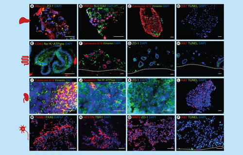 Figure 3. Characterization of the induced pluripotent stem cell-derived liver, intestinal, renal and neuronal model cocultivated in the four-organ-chip for 14 days.Immunostaining A–P: A–D liver spheroids: (A) albumin and ZO-1, (B) Hepatocyte nuclear factor 4 alpha and SLC10A1, (C) cytokeratin 8/18 and vimentin, (D) Ki67 and TUNEL. (E–H) intestinal model: (E) CDX2 and Na+/K+-ATPase, (F) cytokeratin 8/18 and vimentin, (G) ZO-1, H: Ki67 and TUNEL. (I–L) renal model: (I) cytokeratin 8/18 and vimentin, (J) aquaporin 1 and Na+/K+-ATPase, (K) ZO-1, (L) Ki67 and TUNEL. (M–P) neuronal model; (M) TUBB3 and PAX6, (N) nestin and TBR1, (O) MAP2 and ZO-1, (P) Ki67 and TUNEL. Scale 50 μm.