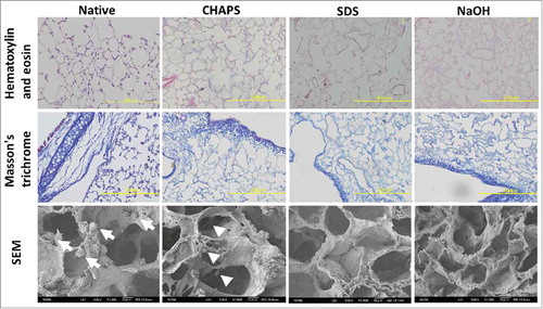 FIGURE 2. Histopathological examination and Scanning electron microscopy of native, CHAPS-treated, SDS-treated and NaOH-treated decellularized lungs. Scale bar = 200 μm.