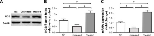 Figure 1 (A) The Western blot study suggested that retinal NGB expression in untreated eyes was significantly lower than in normal controls. (B) The retinal NGB level in the treated eyes was significantly higher than in normal controls. The retinal NGB level in the treated eyes was significantly higher than in untreated eyes, suggesting the AAV vector mediated pronounced NGB overexpression in the treated eyes. (C) The mRNA level of NGB in untreated eyes was significantly lower than that in normal controls. However, the mRNA level of NGB in the treated eyes was significantly higher than in normal controls. All values are presented as mean ± SD; #P<0.01 for differences compared between eye groups.