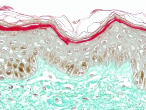 Figure 12 Skin section of one sample explant on day 8 (untreated batch).