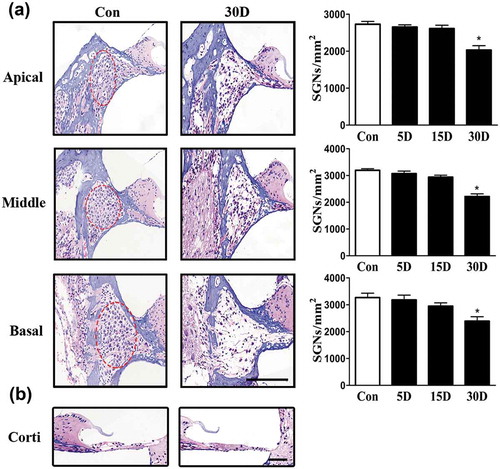 Figure 2. SGN degeneration in the cochlea of mice was successfully established following the destruction of cochlear sensory epithelial cells. (a) Morphological changes of SGNs (red circle) in the apical, middle, and basal turn of the cochlea from the normal and experimental group, as determined with HE staining under a light microscope. The quantified SGN density in each turn is shown on the right panel. In the experimental group, the SGN density progressively decreased. (b) Morphological changes of the organ of Corti taken from the middle turn of cochlea from the normal and experimental group. The sensory epithelial cells and tunnel of Corti were disrupted and collapsed in the experimental groups. *, compared with that in the blank control group, the SGN density was significantly lower (P < 0.05). Data are represented as the means ± SD; n = 6 for each time point. Con, normal mice without drug treatment; 30D, 30 days after the end of the drug administration. Scale bar: 100 µm.