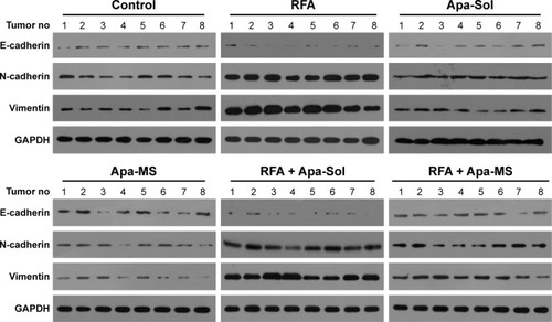 Figure 6 Apa-MS but Apa-Sol inhibited the EMT of HCC cells induced by RFA at protein level. Tumors from solvent control group, RFA group, Apa-Sol group, Apa-MS group, RFA + Apa-Sol group or RFA + Apa-MS group were harvested, and total protein was extracted. The protein level of E-cadherin, N-cadherin and vimentin was examined by their antibodies. GAPDH was chosen as a loading control.