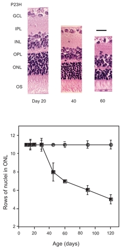 Figure 1 Retinal function and morphology in P23H rats during their development. Changes in retinal morphology and function by ERG of P23H rat are demonstrated. Hematoxyline-eosine staining of retinal sections at 1 mm from optic disc of P23H rat eyes during different ages were photographed (A), and rows of ONL nuclei were analyzed (B) as described in Materials and methods.