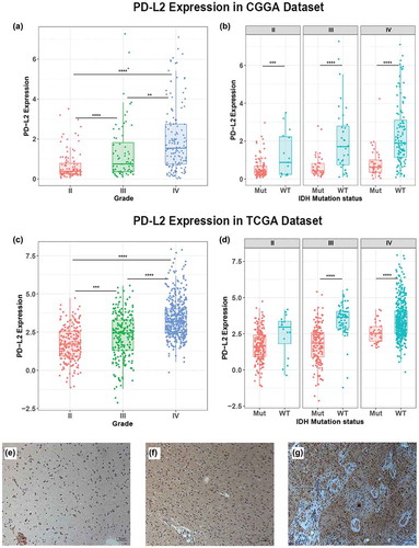 Figure 1. Comparison of PD-L2 expression level in CGGA and TCGA cohorts with different WHO grades (a, c) and IDH status (b, d). PD-L2 was significantly increased in GRADE IV and IDH-wildtype gliomas in CGGA and TCGA data set. Photographs of immunohistochemical staining of PD-L2 in different grades of gliomas. Positive cells are stained brown. (e) Diffuse astrocytoma (WHO grade II). (f) Anaplastic astrocytoma (WHO grade III). (g) Glioblastoma multiforme (WHO grade IV). Magnification, x200. *, **, ***, and **** indicate p < 0.05, p < 0.01, p < 0.001 and p < 0.0001, respectively.
