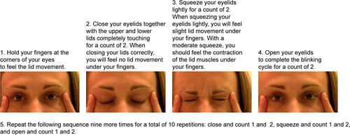 Figure S1 Blinking exercises.Note: Perform 10 repetitions every hour for a minimum of 10 times per day every day.