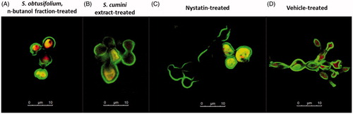 Figure 3. Effects on biofilm viability. This is a representative 2-D confocal imaging of Candida albicans biofilms treated with (A) Nb fraction from S. obtusifolium extract (5xMIC: 312.5 μg/mL); (B) S. cumini hydroalcoholic extract (5xMIC: 625 μg/mL); (C) Nystatin (MIC: 0.97 μg/mL) [positive control]; and (D) Vehicle (negative control). The structures depicted in green (Concanavalin A, Alexa Fluor® 488 Conjugate) represent the yeast cell wall, and those depicted in yellow (FUN® 1 Cell Stain) are nonviable cells, metabolically inactive. The viable cells, in turn, convert the dye FUN-1 to red fluorescent aggregates (63x optical magnitude, 2.85 zoomed-in). Concanavalin A selectively binds to polysaccharides, including alpha-mannopyranosyl and alpha-gluco-pyranosyl residues, and gives a green fluorescence. FUN-1 is a fluorescent dye taken up by yeast cells; in the presence of metabolic viability it is converted from a diffuse yellow cytoplasmic stain to red. It can be noted that both Sc and Nb fraction affected the viability of C. albicans cells when compared to the vehicle.