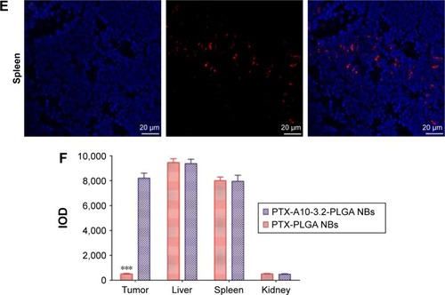 Figure 10 Distribution of different formulations of DiI-labeled NBs in the cryosections of different organ tissues by LCSM and IOD in the different organ tissues.Notes: (A–E) Distribution of different formulations of DiI-labeled NBs in the tumor, liver, spleen, and kidney. (F) IOD in the tumor, liver, spleen, and kidney. PTX-PLGA NBs compared with PTX-A10-3.2-PLGA NBs, ***P<0.001. Blue indicates cell nuclei; red dots indicate DiI-labeled NBs.Abbreviations: DAPI, 4′,6-diamidino-2-phenylindole; DiI, 1,1′-dioctadecyl-3,3,3′,3′-tetramethylindocarbocyanine perchlorate; IOD, integrated optical density; LCSM, laser confocal scanning microscopy; NBs, nanobubbles; PLGA, poly(lactide-co-glycolic acid); PTX, paclitaxel.