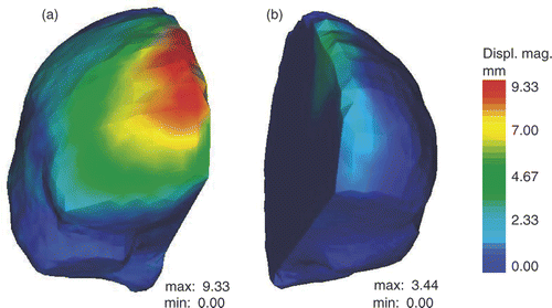 Figure 4. Results of the active surface algorithm for the two hemispheres of the brain. (a) Initial active surface for right hemisphere with color levels corresponding to the magnitude of the displacement field. (b) Initial active surface for left hemisphere with same color coding. (In accordance with radiological convention, the right side of the iMR images corresponds to the left side of the brain, and vice versa.