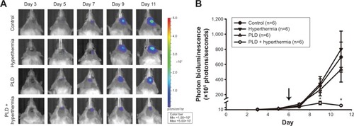 Figure 4 IVIS imaging of mouse brain tumors from day 3 to day 11 after tumor implantation.Notes: (A) Mice with luciferase-expressing 4T1-luc2 breast cancer cells implanted in their striatum tissue. There were four groups: control (no treatment), hyperthermia, PLD, and PLD + hyperthermia. Treatment was executed on day 6 after tumor implantation, and images were obtained every other day. (B) Bioluminescent signals were quantified using the IVIS imaging system. The arrow indicates when the different treatments were performed. Note that PLD + hyperthermia markedly inhibited breast tumor growth in the brain. Data are presented as the mean ± SEM (n=6 for each group). *P<0.05 compared with the control group.Abbreviations: PLD, pegylated liposomal doxorubicin; SEM, standard error of the mean.