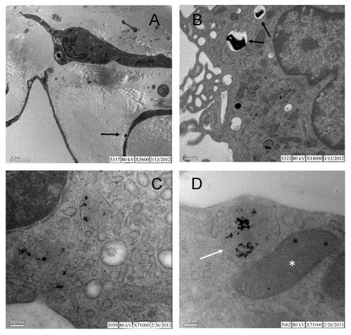 Figure 5. Representative transmission electron microscopic images of AuNP localization. By enlarge AuNPs were scattered throughout the cytoplasm and organelles of synoviocytes including the smooth endoplasmatic reticulum and mitochondria (C and D). Extracellular location of large particle agglomerates were also appreciated (A and B). Evidence for larger AuNPs agglomerates in endosomes (white arrow) is illustrated in (D).